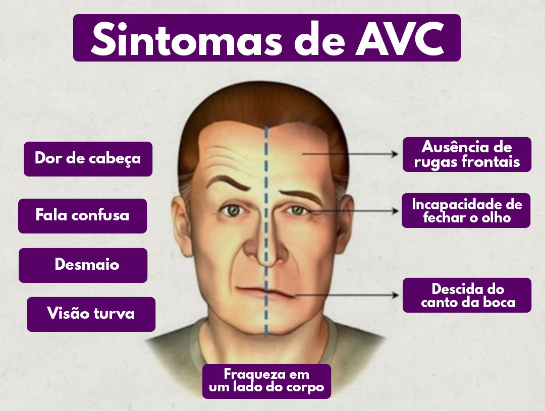 Você conhece os sintomas do AVC?